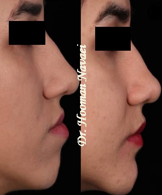 جراحی فک دکتر هومن نوایی