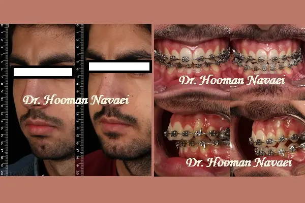 ارتوگناتیک