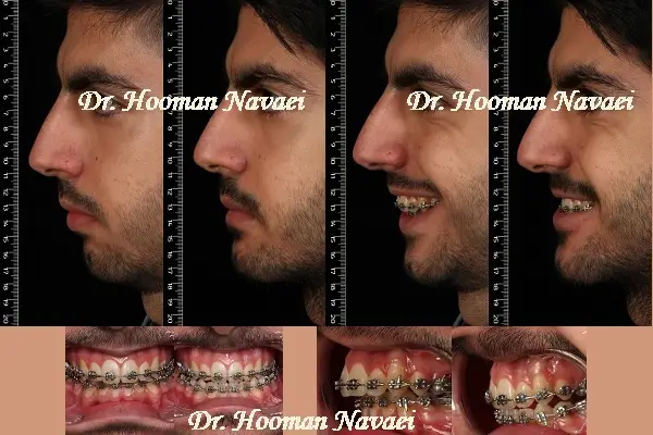 ارتوگناتیک