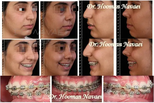 ارتوگناتیک