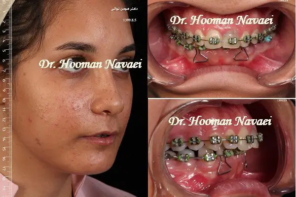 جراحی اصلاح ناهنجاری فکی