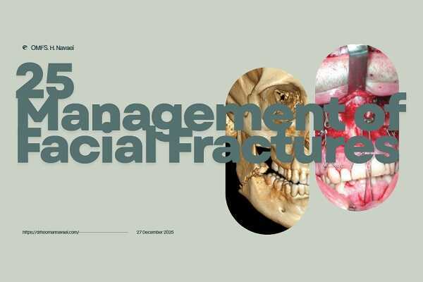 ۲۵ درمان شکستگی‌های صورت