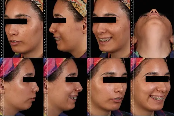 جراحی اصلاح ناهنجاری فکی