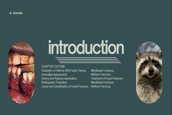 شکستگی های صورت